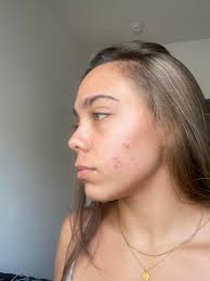 What are your favorite skin care and makeup tips for combo skin?