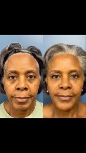 You hear that @deezlegetsgrammys? These millenials have you and Lil Wayne  to blame for these wrinkles. 🥴🧓🏻 #amilli #awrinkle #laughlines