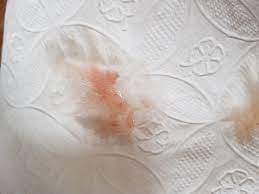 Blut Im Speichel Was Kann Es Sei