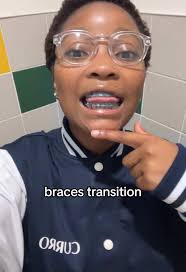 Braces Transition: The Journey to a New Smile