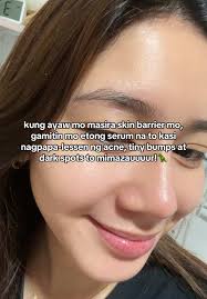 Achieve Clear Skin with Our Anti-Acne Serum