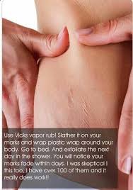 vapor rub stretch marks wrap body sleep shower and exfoliate marks will fade in days vicks vapor rub beauty hacks health and beauty
