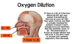 This device consists of a lightweight tube which on one end splits into two prongs which are placed in the nostrils and from which a mixture of air and oxygen. Cureus High Flow Nasal Cannula Mechanisms Of Action And Adult And Pediatric Indications