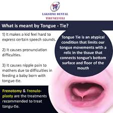These flu strains are characterized by their differing informs of surface proteins. Does Your Kid Strain Much To Lakshme Dental Tirunelveli Facebook