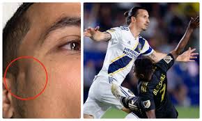 It may take a few seconds for larger groups to appear in your groups list. Lee Nguyen Teammate Deformed Face 24h Football