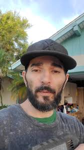 It's just completely flat. Plus it's oxidized. CsL and Exo only lasted 2  years. Smh