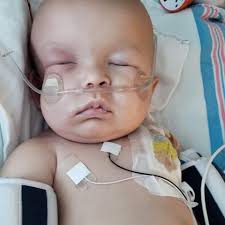 Ok so long story short (I promise this is the short version) back in 2017 a  few months after I had my youngest I noticed she was sick. I took her to