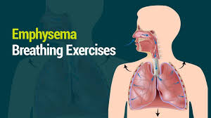 Lung Health Institute Emphysema Breathing Exercises Breathing Exercises Exercise Lungs Health
