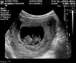 Baby Ultrasound Los Angeles Best Baby Sonogram Beverly Hills