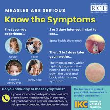 Image result for measles