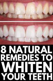 The easiest way to whiten your teeth is to prevent stains and yellowness from developing in the first place. How To Whiten Teeth Naturally 8 Tips And Products That Work