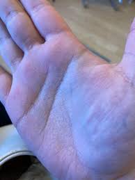 Schrumpelige Handflache