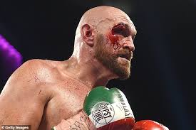 Otto wallin (right) is set to face tyson fury in las vegas in september (getty images). Otto Wallin Targets Tyson Fury Rematch After Gypsy King Needed 47 Stitches Following First Fight Daily Mail Online