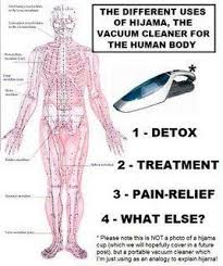 Wet Cupping Therapy Al Hijama Hijama Cupping Therapy Wet Cupping