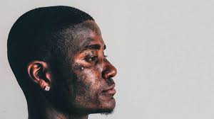 Dermal Piercing Pictures Placement Procedure Care Risks More