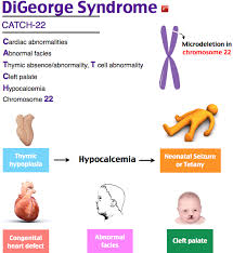 Rosh Review Digeorge Syndrome Pediatric Nurse Practitioner Nursing School Survival