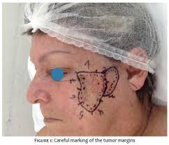 Surgical & Cosmetic Dermatology