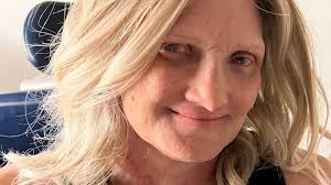 Fundraiser for Laura Hampton by Mecca Givens : Help Laura See Again: Fund  Her PROSE Lens