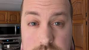 Fundraiser for Lance Aeby by Deb Aeby : Help Lance Kick Lyme!