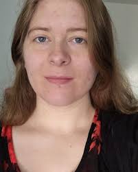 Find Therapists and Psychologists in 98001