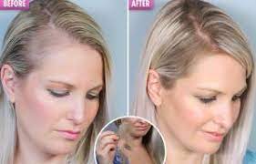 Vodka has been around since the early middle ages, and is one of the world's most. The 7 Reasons Booze Is Causing Your Hair Loss And Could Leave You Bald