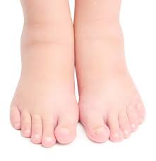 Get to a doctor to have it checked out. Common Foot Tumors Cincinnati Foot Ankle Care