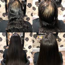 Click here for salons outside the united states. Hair Integration Systems Hair Loss Systems Halo Salon