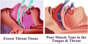 Dr David Anaise Author At Veteran Disability And Long Term Disability Arizona Md Lawyer