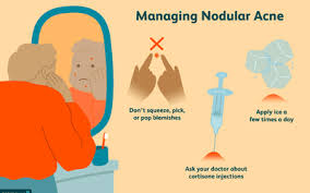 Overview Of The Types And Stages Of Acne