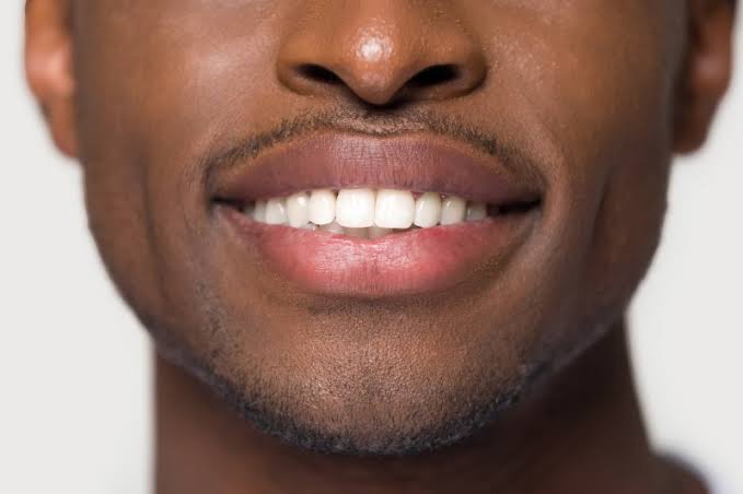Benefits of Porcelain Veneers | Dentist in Chaska | Dr. Mark Stapleton