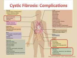The body produces thick and sticky mucus that can clog the lungs and obstruct the pancreas. Cftr Genetics In Pancreatitis And Cystic Fibrosis Broadcastmed