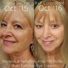 What to do about wrinkles