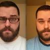 You can apply beard oil up to three times a day without worrying about overdoing it. 1