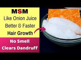 Msm natural hair growth products are rich in sulfur, msm vitamins deliver sulfur to your body and sulfur for hair growth is very important because it's a critical component of many different proteins in your body, including enzymes. Msm Hair Regrowth Mask Works Better Than Onion Juice And Treats Itchy Scalp Dandruff Hair Loss Youtube Hair Regrowth Hair Growth Hair Growth Rate