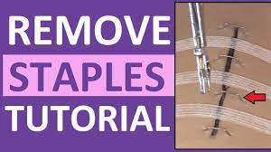 This video will demonstrate the steps on how to properly remove surgical staples on a patient who ha. Surgical Staple Removal Nursing How To Remove Surgical Staples Youtube