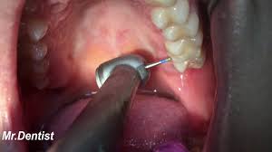 What goes into the passport application? How Long Does It Take To Fill A Cavity Teethwalls