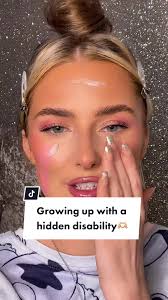 I Was Molded As A Child with Syndrome