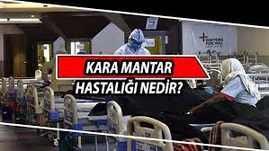 Kara mantar hastalığının belirtileri neler? Kara Mantar Hastaligi Hindistan I Alarma Gecirdi Kara Mantar Mukormikoz Hastaligi Nedir Belirtileri Nelerdir Son Dakika Guncel Haberler