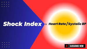 Image result for Shock Index