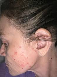 Good Afternoon my fellow SARCOIDOSISIANS, and HAPPY NEW YEAR. It's been  awhile since I've posted so let me get straight to it. Is pain associated  with SARC? Does NAPROX EN work for