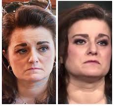 Did she get her teeth done?