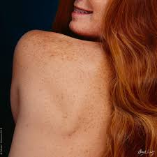 Server hd server hd7 server x3 server co. Redheads