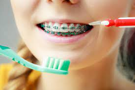 Christmas tree toothbrush for braces. Brushing With Braces Flossing With Braces Salaita Orthodontics