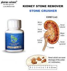 Pin On Kidney Stones