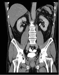 Radiology multiple choice questions and answers for competitive exams. Radiology Quiz Urology News