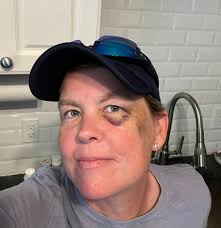 I noticed someone painted these tree roots