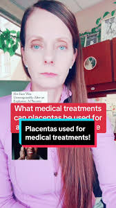 Shannon M. Clark, MD, FACOG (@babies_after_35)’s video of placenta