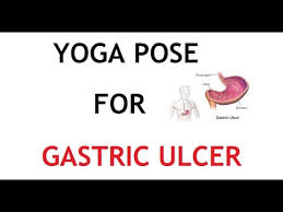 Check spelling or type a new query. 3 Yoga Pose For Gastric Ulcer à¤†à¤® à¤¶à¤¯ à¤› à¤² à®‡à®° à®ª à®ª à®ª à®£ Youtube