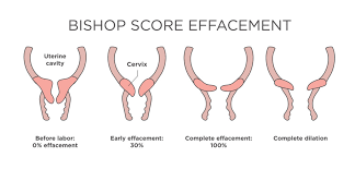 Image result for cervix position