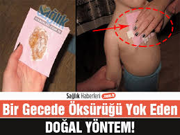 Bir Gecede Oksurugu Geciren Dogal Yontem Saglik Saglik Ipuclari Dogal